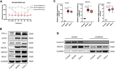 Dexmedetomidine inhibits abnormal muscle hypertrophy of myofascial trigger points via TNF-α/ NF-κB signaling pathway in rats